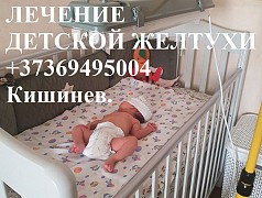 Напрокат медицинская Лампа для лечения желтухи Кишинёв мун.
